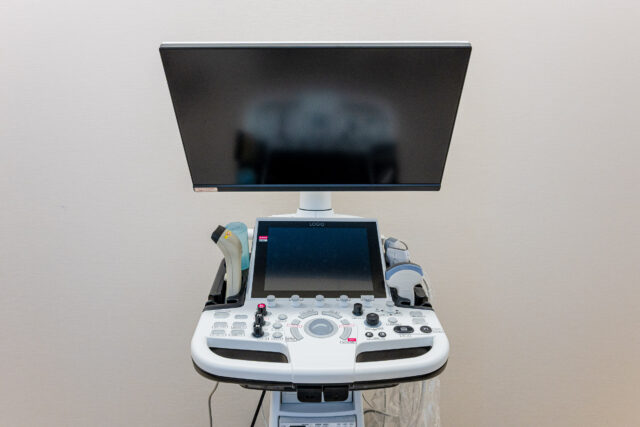 超音波診断装置